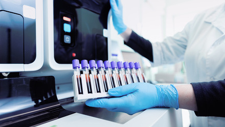 Loading blood samples into a machine