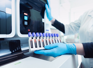 Loading samples into machine.jpg