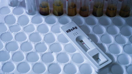 Rapid test for HBsAg