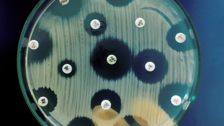 Bacteria on an agar plate
