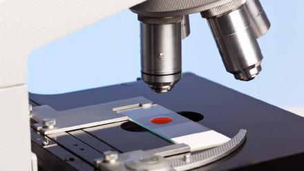 Photo of a laboratory microscope with a blood sample on a glass slide