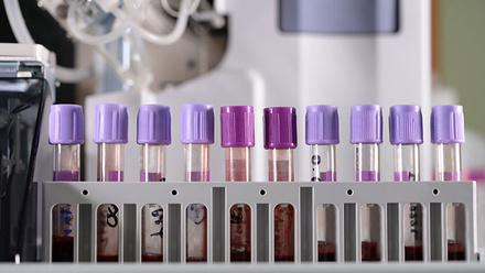 test_tubes_chemical_pathology_33449081_785x400px.jpg